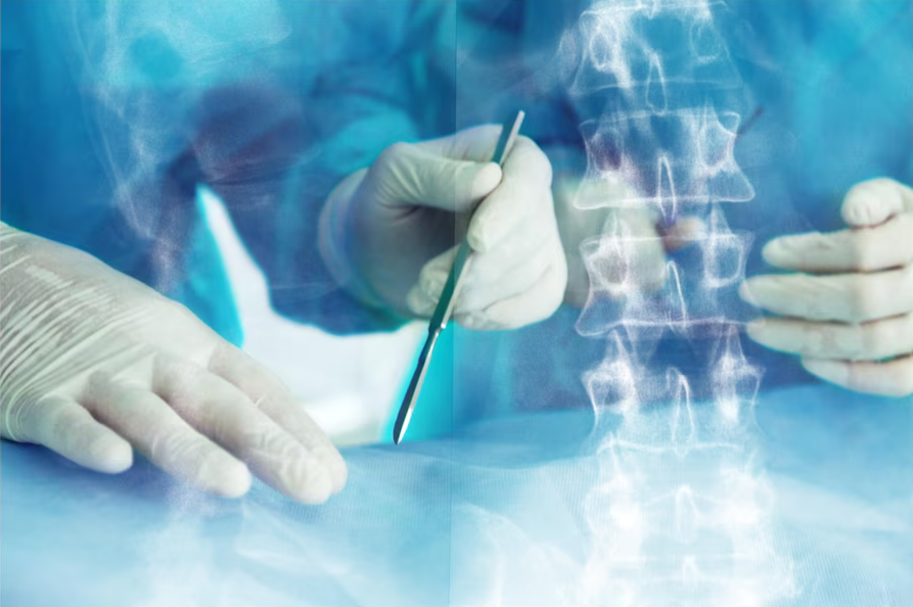 Spinal Surgery Simulation: 5 Key Advances for Better Outcomes