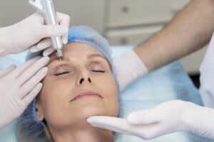 how to qualify for eyelid surgery