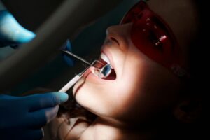 impacted wisdom teeth removal surgery oxnard