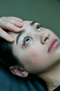 how to qualify for eyelid surgery