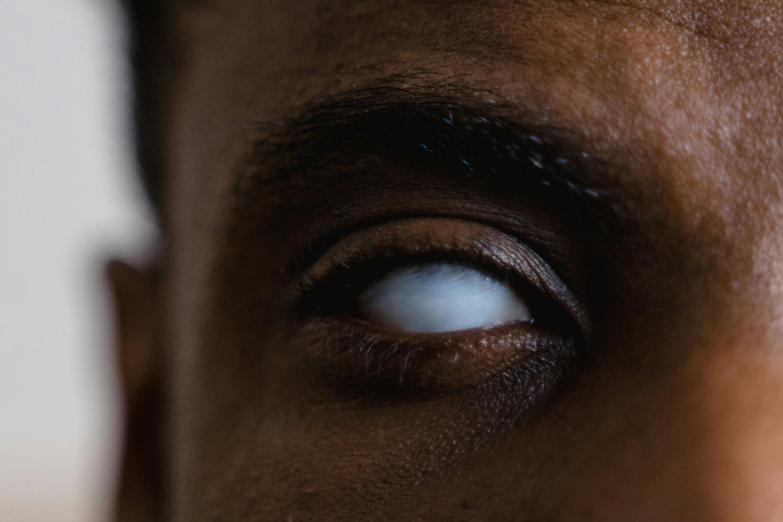 Cosmo Eye Disease: Effective Treatments for Dry Eyes & Stye