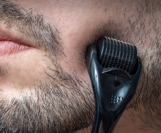 What is a Derma Roller